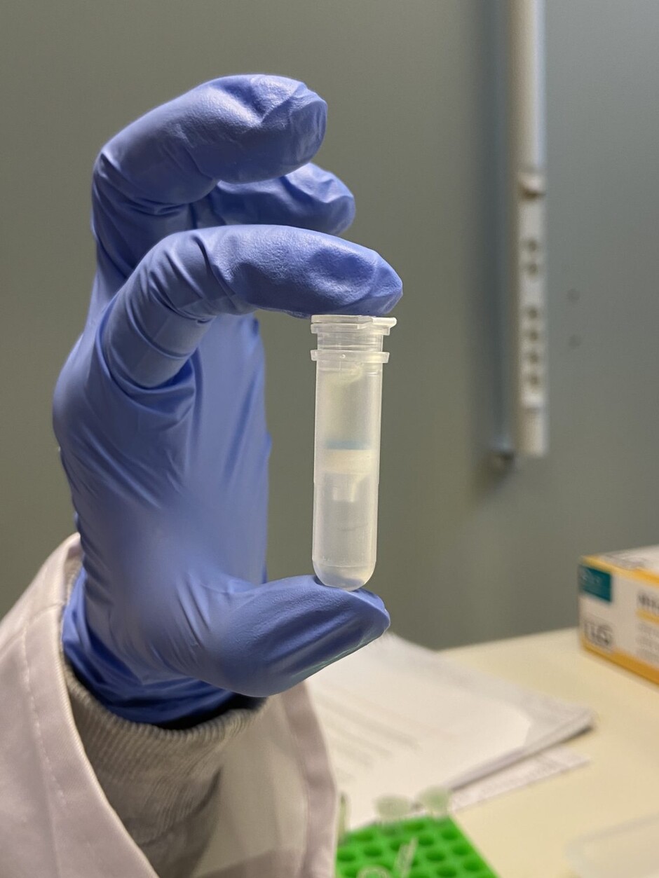 DNA-prøve i rør